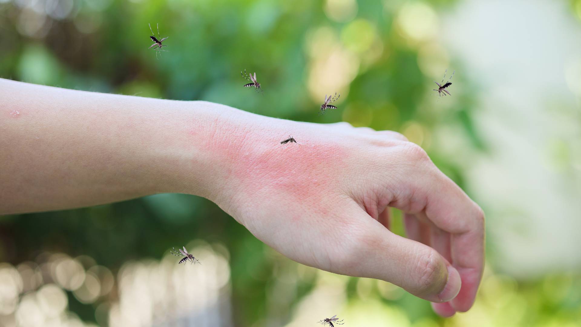 mosquitoes biting a hand