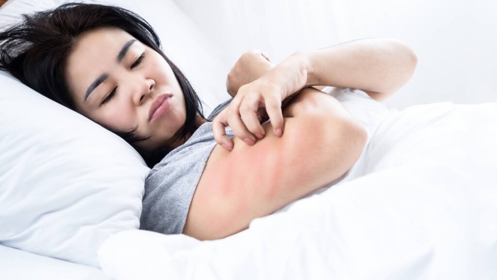 girl scratching her arm due to bed bugs to illustrate how much does bed bug treatment in house cost