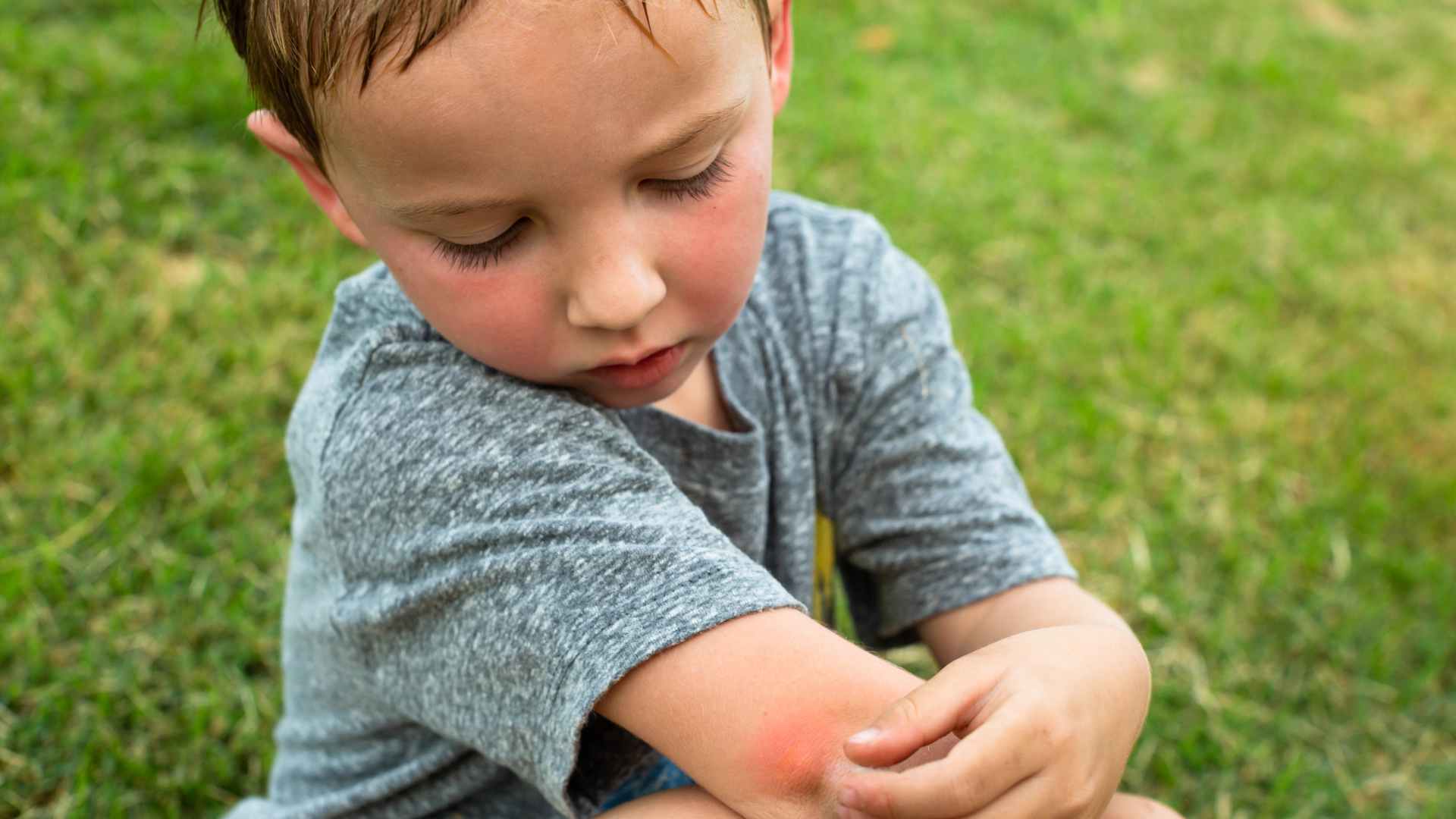 Best Way to Keep Mosquitoes Away from Patio: Top Solutions