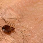 beyond the bite of bed bugs in bed.